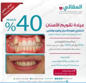 سعر تقويم الأسنان في السعودية