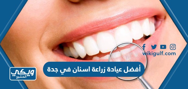 أفضل عيادة زراعة اسنان في جدة