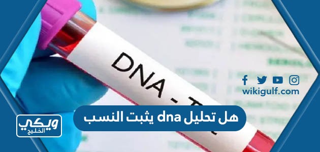 هل تحليل dna يثبت النسب في السعودية أم لا