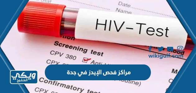 مراكز فحص الإيدز في جدة